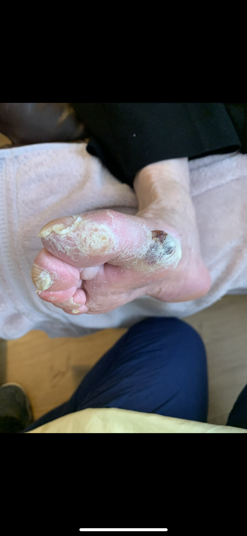 After treatment
