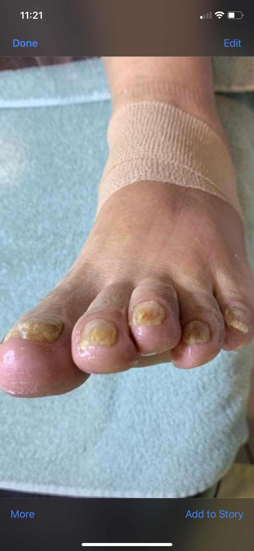 After treatment