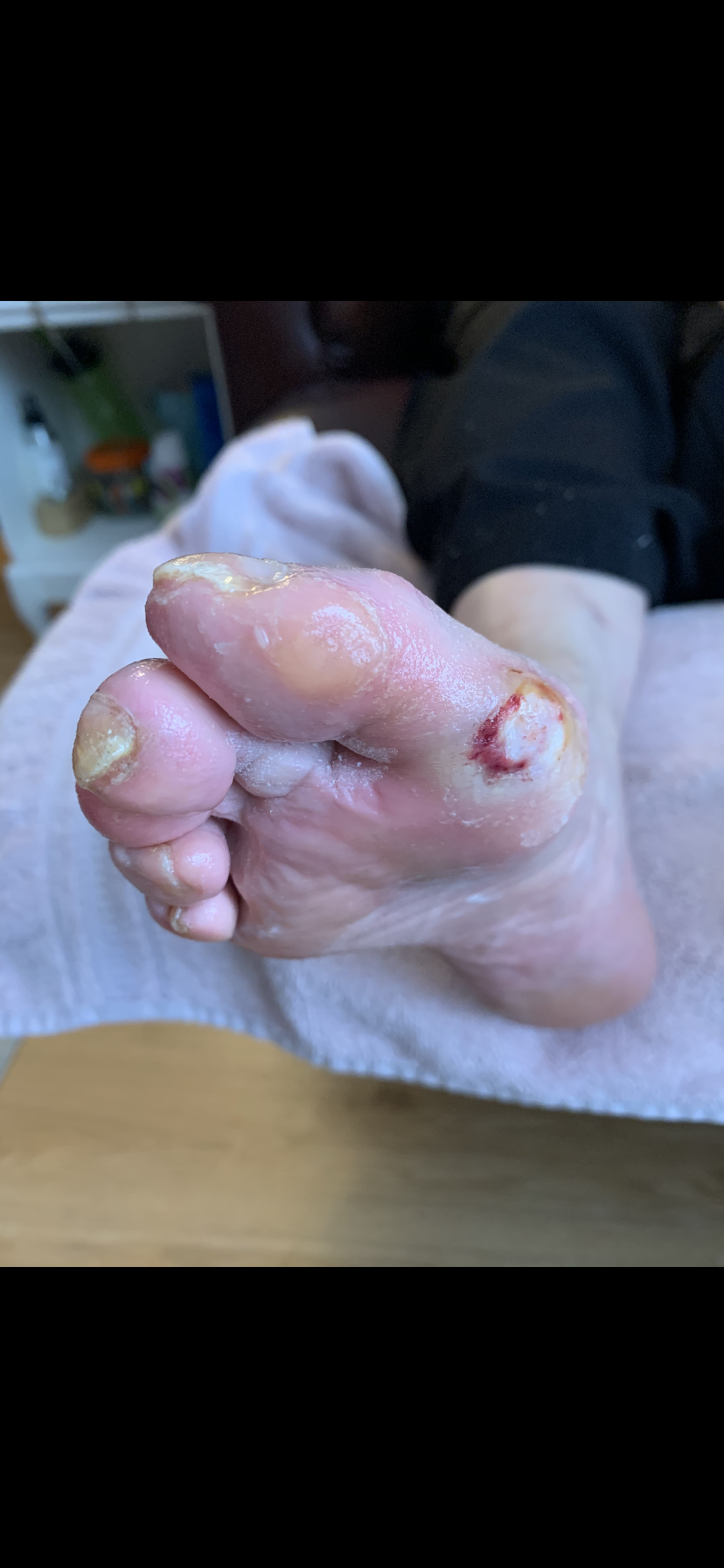 Before treatment