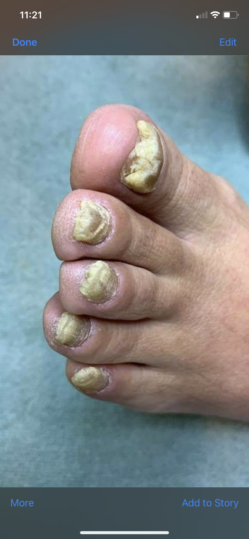 Before treatment